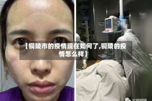 【铜陵市的疫情现在如何了,铜陵的疫情怎么样】
